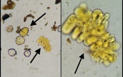 Similar às amebas, parasita pode ser identificado por exame parasitológico de fezes