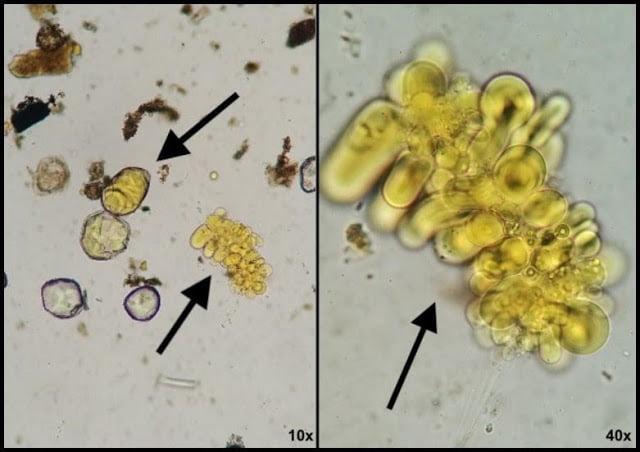 Similar às amebas, parasita pode ser identificado por exame parasitológico de fezes