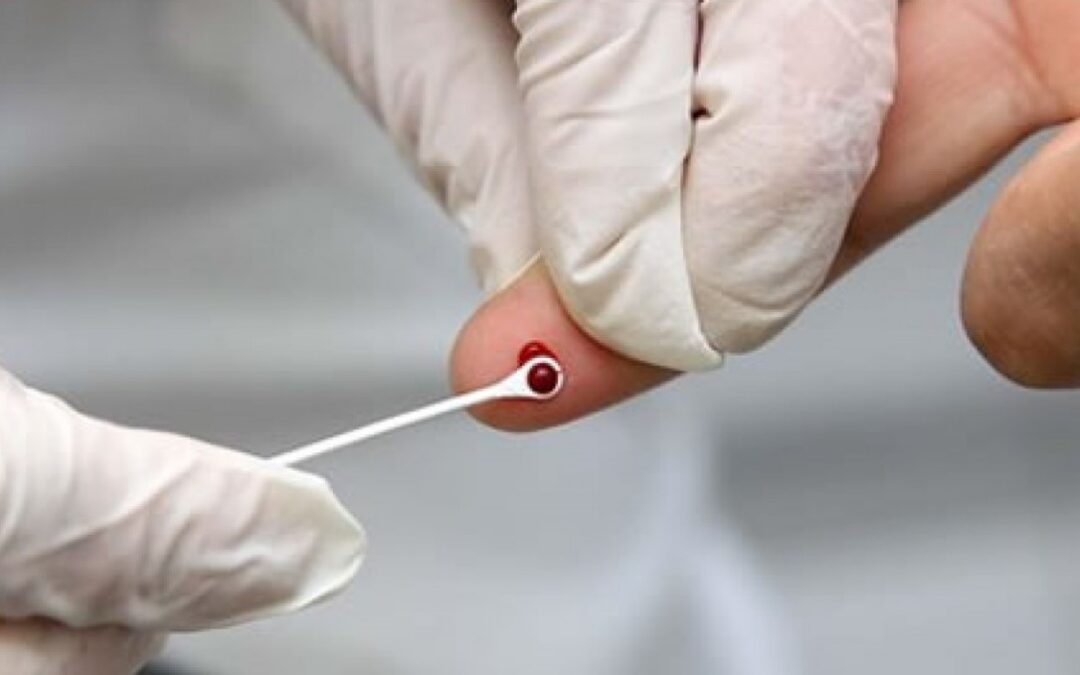 Ministério da Saúde suspende kits de autotestes de HIV por falta de linha de controle