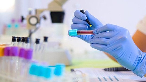 Novo teste promete revolucionar o diagnóstico de doenças infecciosas