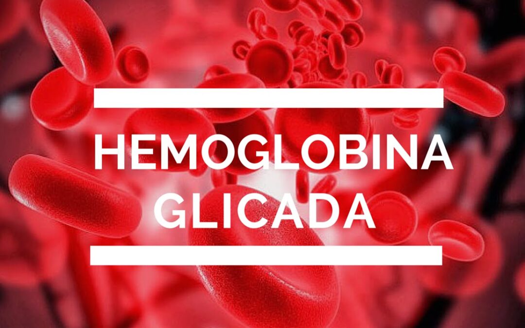 Sebia lança selo de qualidade para teste de Hemoglobina Glicada