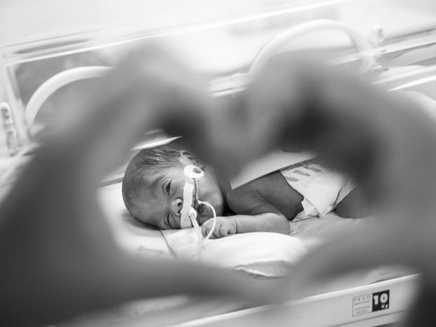 Teste pode salvar vida de bebês internados em UTI