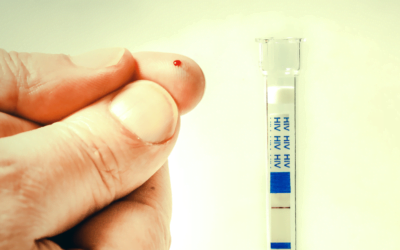 Testes Rápidos (POC) serão tema de mesa-redonda no 53º CBPC/ML