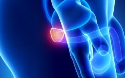 Pesquisadores desenvolvem novo teste para diagnóstico de câncer de próstata