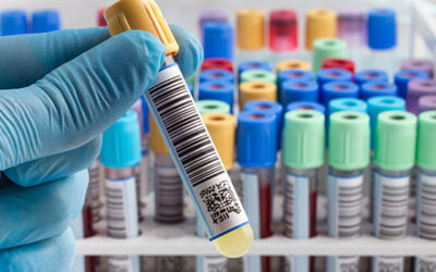 Disponível a segunda versão do Guia sobre Coleta de Amostras Laboratoriais da Anvisa