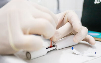 Testes rápidos para detecção de HIV ainda encontram resistência