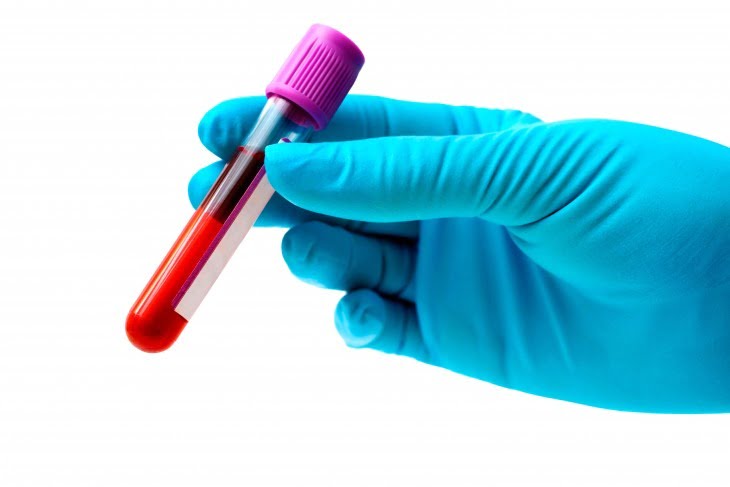 Teste de sangue baseado em expressão gênica pode reduzir uso excessivo de antibióticos