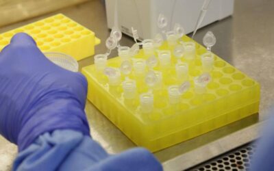 Saiba quais são os testes rápidos para Covid-19 aprovados pela Anvisa