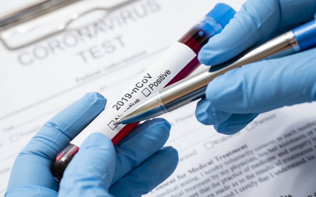 Novo teste detecta coronavírus em apenas 10 minutos
