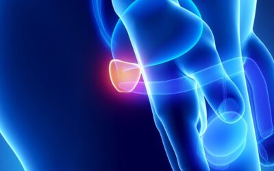 Exame de baixo custo poderá prever diagnóstico de câncer de próstata