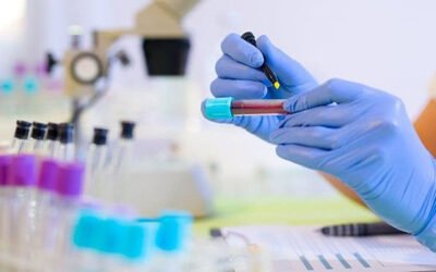 Projeto de testagem em massa proposto ao Ministério da Saúde e Anvisa por entidades de saúde prevê estrutura da sociedade civil