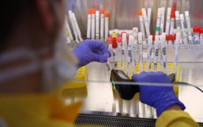 Ministério da Saúde publicou chamamento para aquisição de 12 milhões de testes rápidos