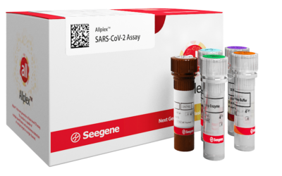 Novo teste molecular para detecção da Covid-19 chega ao Brasil