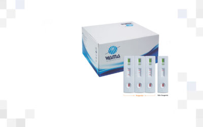 Wama Diagnóstica desenvolve teste rápido para Covid-19