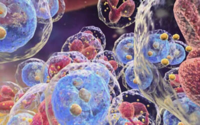 QIAGEN recebe aprovação da Anvisa para teste molecular voltado ao monitoramento de Leucemia Mieloide Crônica