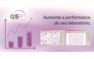 Nova ferramenta permite otimização na análise das lâminas sanguíneas