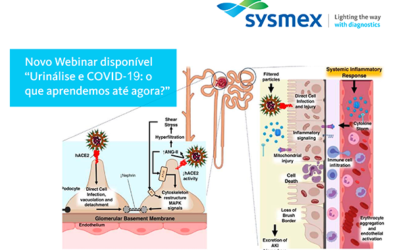 Urinálise e Covid-19, webinar da Sysmex já está disponível para ser assistido