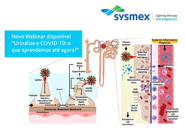 Urinálise e Covid-19, webinar da Sysmex já está disponível para ser assistido
