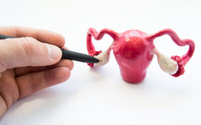 Entenda a diferença entre câncer do colo do útero e câncer do endométrio