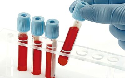 Exame alterado nem sempre significa doença: seis resultados que costumam assustar os pacientes