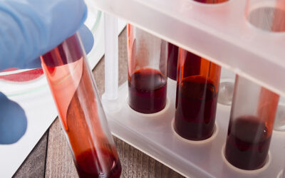 SBPC/ML contribui para a inclusão de mais quatro exames no ROL da ANS