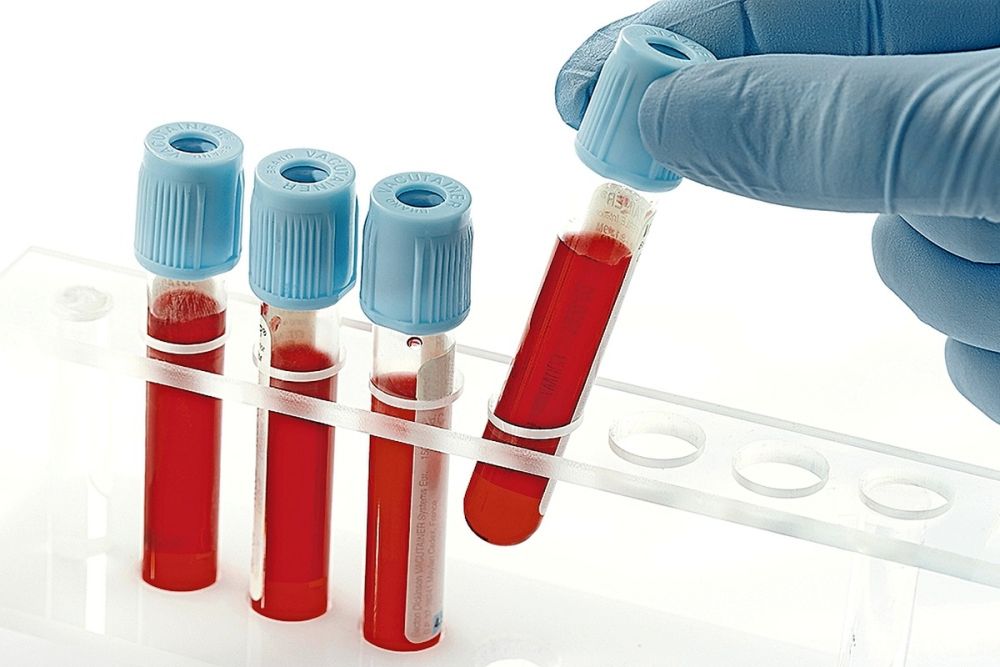 Exame alterado nem sempre significa doença: seis resultados que costumam assustar os pacientes