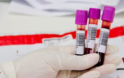 Entenda o que é o exame VHS e sua finalidade