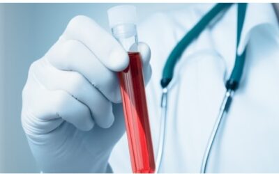 PSA: saiba a importância desse exame