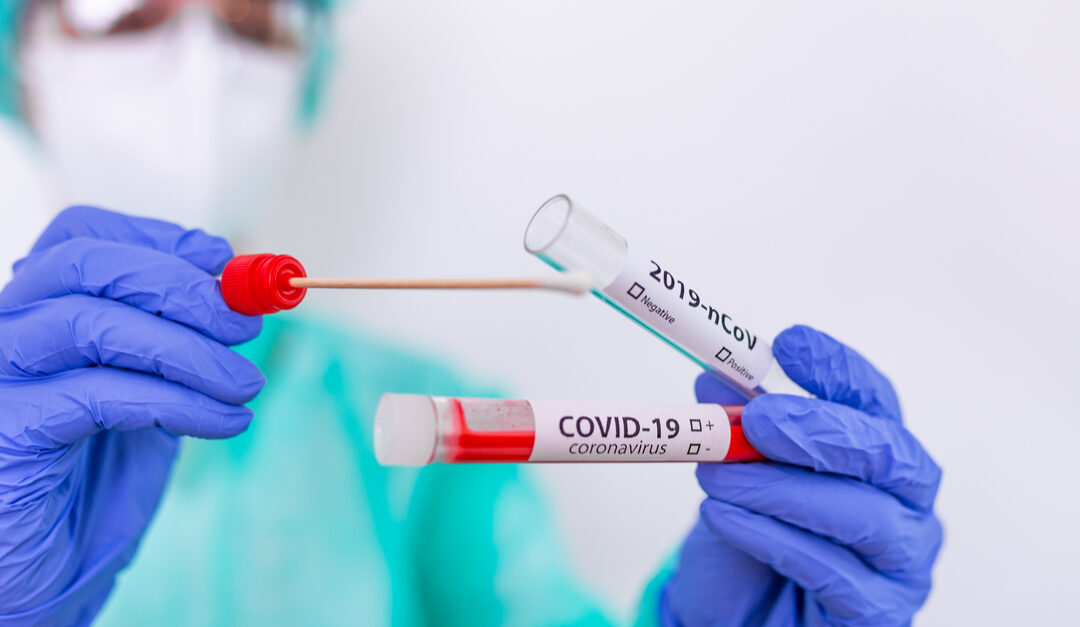 Com mais de 10,2 milhões de testes de COVID-19 em 2020, setor privado foi responsável por 43,1% de todo o diagnóstico do país
