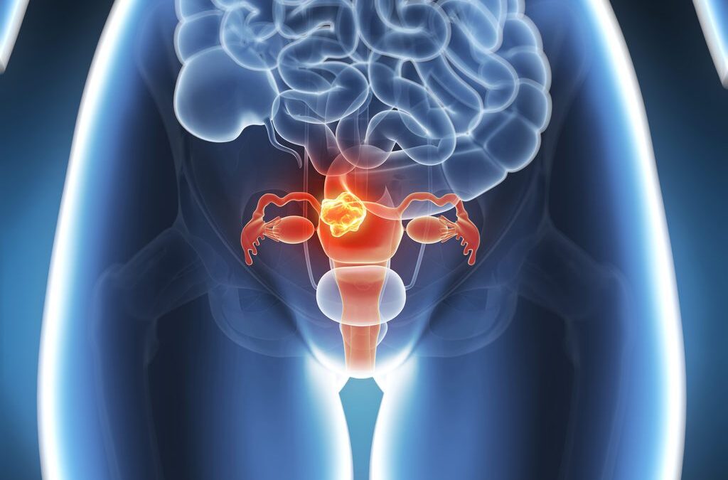 Estudo inédito brasileiro, publicado no The Lancet Regional Health – Americas, revela que é possível erradicar o câncer de colo de útero