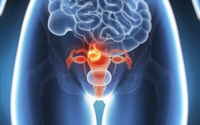 Estudo inédito brasileiro, publicado no The Lancet Regional Health – Americas, revela que é possível erradicar o câncer de colo de útero
