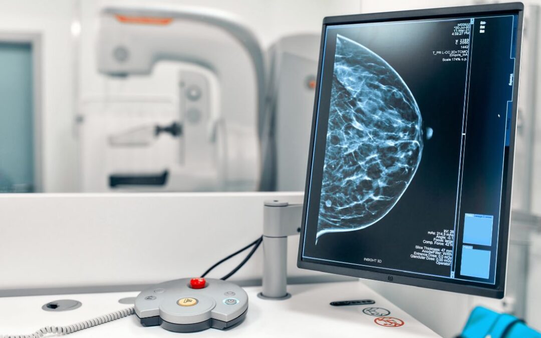 Biópsia tardia agrava o tratamento do câncer de mama, alerta Sociedade Brasileira de Mastologia