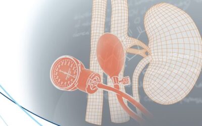 As vantagens da Concentração Direta de Renina no rastreio de Aldosteronismo