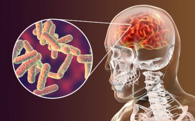 Importância da dosagem de vancomicina no tratamento das meningites