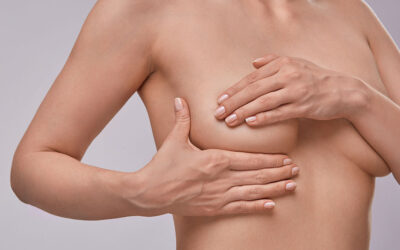 Hábitos saudáveis antes, durante e depois do diagnóstico de câncer de mama diminuem mortalidade e reincidência, aponta estudo