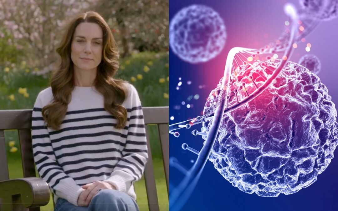 Kate Middleton anuncia diagnóstico de câncer: em todo o mundo, 20 milhões de novos casos da doença surgem a cada ano, indica OMS