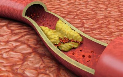 Entendendo o exame de colesterol: quando devo me preocupar?