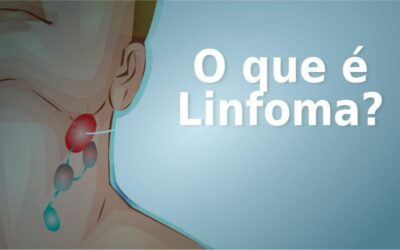 INCA estima 15.120 novos casos por ano de linfomas entre 2023 e 2025