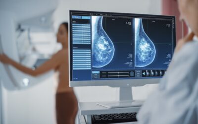 Notícia sobre idade mínima de mamografia que circula é falsa. ANS propõe justamente o oposto: expandi-la