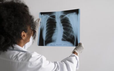 bioMérieux realiza webinar gratuito sobre tuberculose latente no dia 19 de março