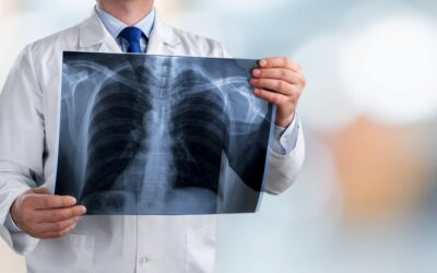 SPR promove desafio global de IA para aprimorar análise de mamografias