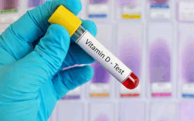 Busca por exames de dosagem de vitaminas no sangue dispara após a pandemia: saúde, tendência ou exagero?