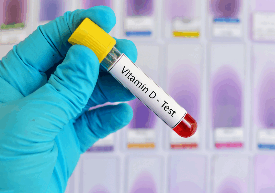 Busca por exames de dosagem de vitaminas no sangue dispara após a pandemia: saúde, tendência ou exagero?