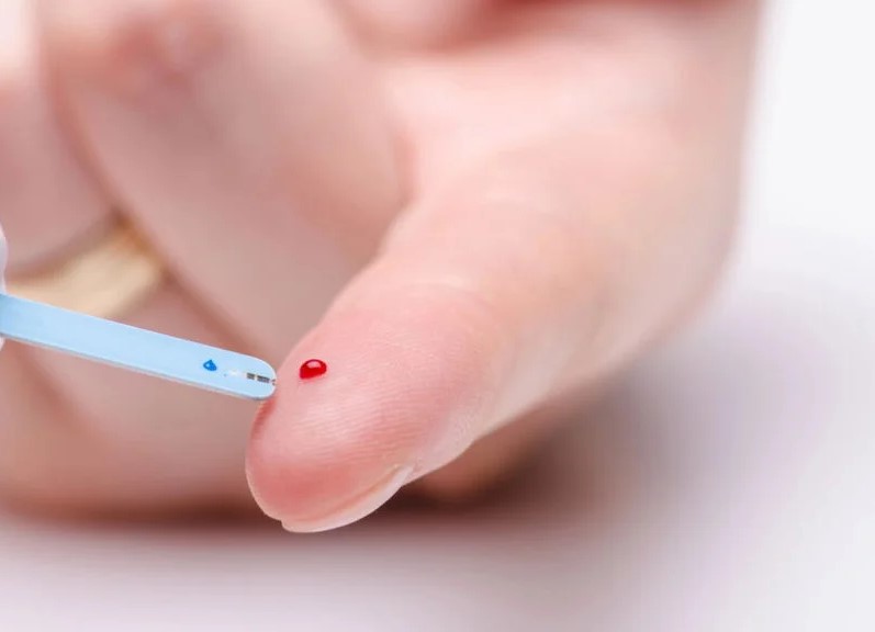 Roche e Grupo RD Saúde realizam primeira parceria na América Latina e criam marca própria de medidor de glicemia