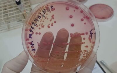 Fiocruz e Cepen investigam RAM de bactérias Klebsiella e Pseudomonas aeruginosa