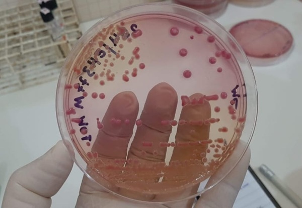 Fiocruz e Cepen investigam RAM de bactérias Klebsiella e Pseudomonas aeruginosa