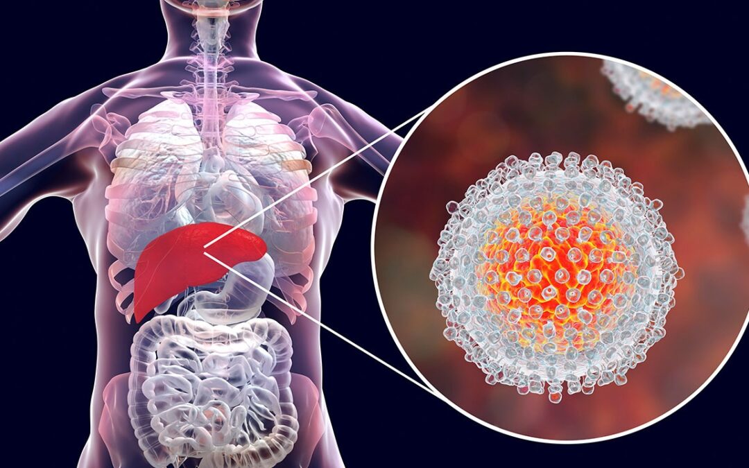 Testes para detectar as hepatites virais contam com tecnologia e automação para apoiar na erradicação da doença