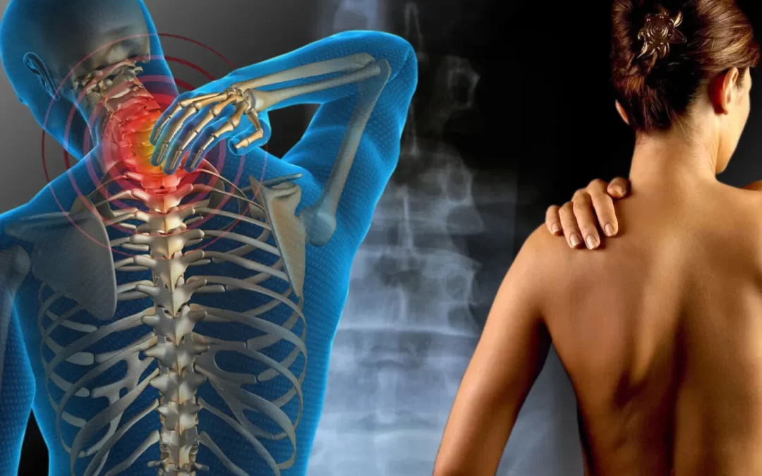 Dia Nacional de Conscientização sobre as Distrofias Musculares alerta para a importância do diagnóstico precoce