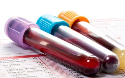 Porque sites de busca e IA podem atrapalhar a leitura correta do seu hemograma  Corriqueiro em laboratórios e consultórios, exame pode revelar diversas doenças, mas apenas médicos, no contexto clínico, podem identificá-las