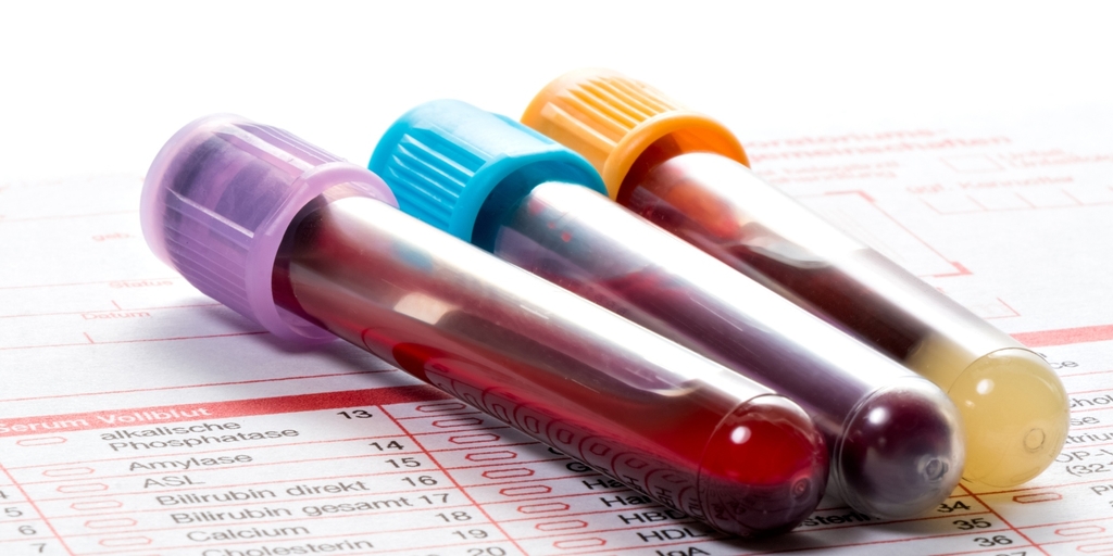 Porque sites de busca e IA podem atrapalhar a leitura correta do seu hemograma  Corriqueiro em laboratórios e consultórios, exame pode revelar diversas doenças, mas apenas médicos, no contexto clínico, podem identificá-las